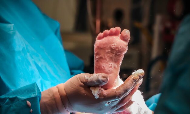 Aumento de porcentaje en menores quemados mantiene en alerta a especialistas del Hospital Regional